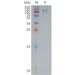 SDS-PAGE - Recombinant Human Periostin Protein (6×His Tag) (A317793) - Antibodies.com