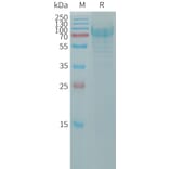 SDS-PAGE - Recombinant Human PODXL2 Protein (6×His Tag) (A317794) - Antibodies.com