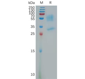 SDS-PAGE - Recombinant Human PK-R1 Protein (Fc Tag) (A317795) - Antibodies.com