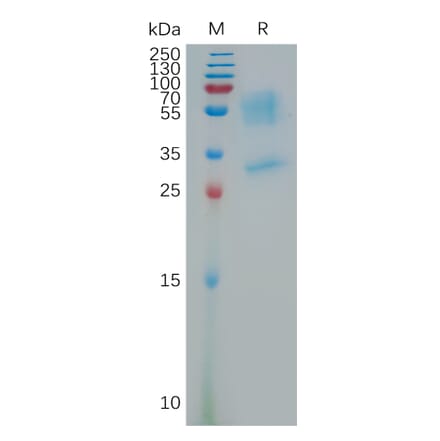 SDS-PAGE - Recombinant Human PK-R1 Protein (Fc Tag) (A317795) - Antibodies.com