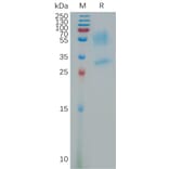 SDS-PAGE - Recombinant Human PK-R1 Protein (Fc Tag) (A317795) - Antibodies.com