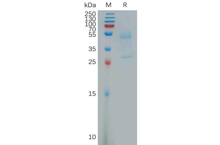 SDS-PAGE - Recombinant Human MSMP Protein (Fc Tag) (A317796) - Antibodies.com
