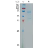 SDS-PAGE - Recombinant Human MSMP Protein (Fc Tag) (A317796) - Antibodies.com