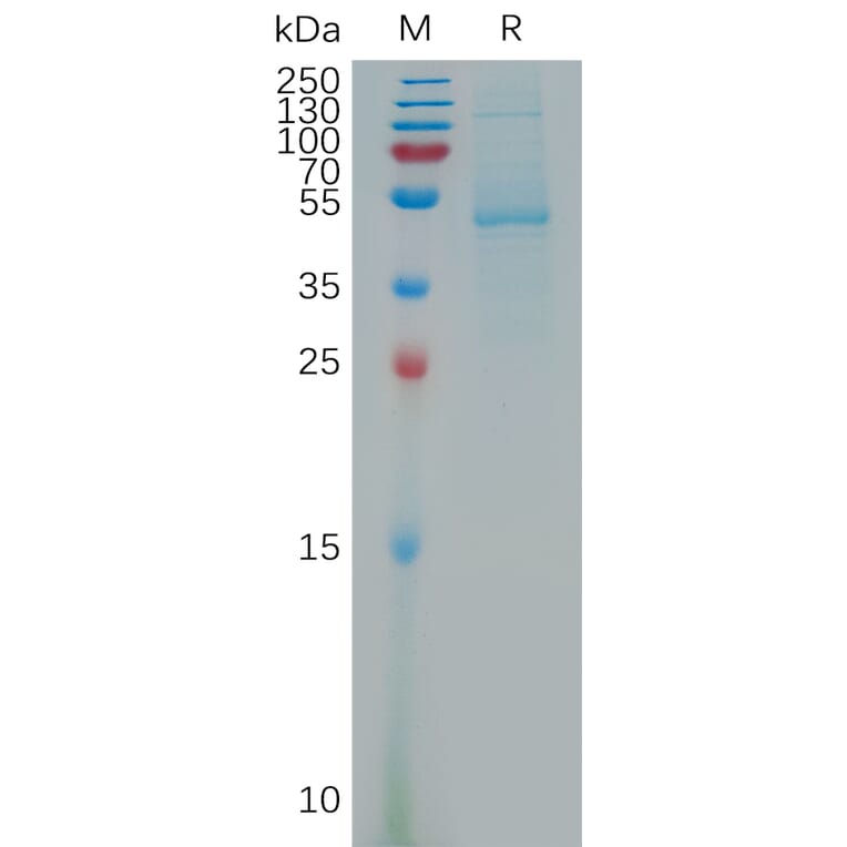 SDS-PAGE - Recombinant Human SCDGFB/PDGF-D Protein (Fc Tag) (A317797) - Antibodies.com
