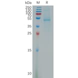 SDS-PAGE - Recombinant Human SCDGFB/PDGF-D Protein (Fc Tag) (A317797) - Antibodies.com