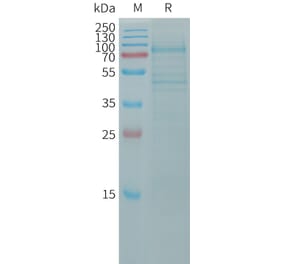 SDS-PAGE - Recombinant Human OB Cadherin Protein (6×His Tag) (A317798) - Antibodies.com