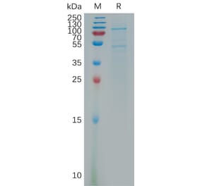 SDS-PAGE - Recombinant Human OB Cadherin Protein (6×His Tag) (A317799) - Antibodies.com