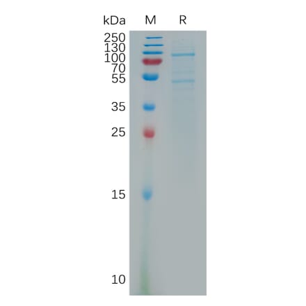SDS-PAGE - Recombinant Human OB Cadherin Protein (6×His Tag) (A317799) - Antibodies.com