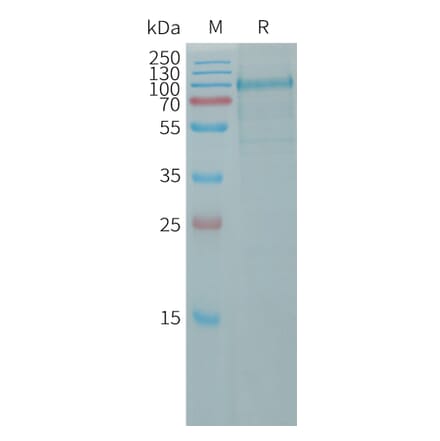 SDS-PAGE - Recombinant Human Cadherin 10 Protein (6×His Tag) (A317800) - Antibodies.com