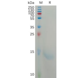 SDS-PAGE - Recombinant Human IL-8 Protein (6×His Tag) (A317801) - Antibodies.com