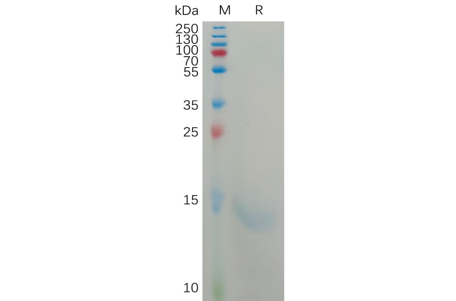 SDS-PAGE - Recombinant Human IL-8 Protein (6×His Tag) (A317801) - Antibodies.com