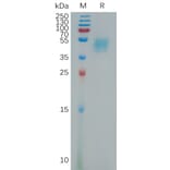 SDS-PAGE - Recombinant Human LRG1/LRG Protein (6×His Tag) (A317806) - Antibodies.com