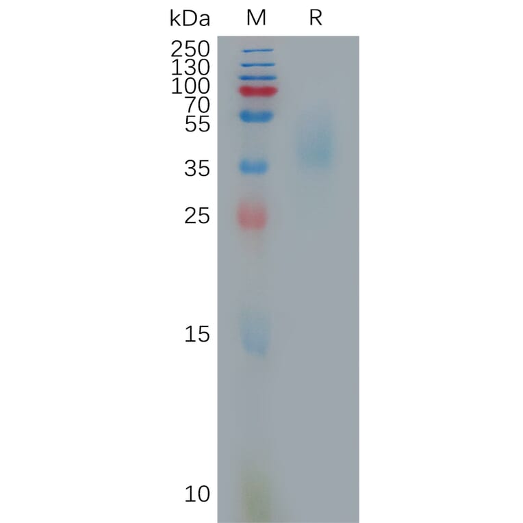 SDS-PAGE - Recombinant Monkeypox Virus OPG105 Protein (6×His Tag) (A317808) - Antibodies.com