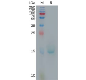 SDS-PAGE - Recombinant Human IL-10 Protein (6×His Tag) (A317809) - Antibodies.com