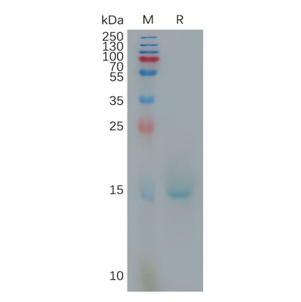 SDS-PAGE - Recombinant Human IL-10 Protein (6×His Tag) (A317809) - Antibodies.com