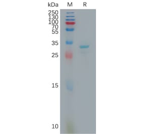 SDS-PAGE - Recombinant Human FGL1 Protein (6×His Tag) (A317810) - Antibodies.com