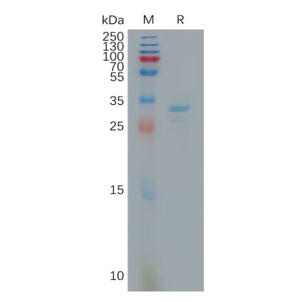 SDS-PAGE - Recombinant Human FGL1 Protein (6×His Tag) (A317810) - Antibodies.com