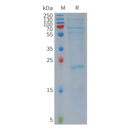 SDS-PAGE - Recombinant Human NLRP3 Protein (Flag Tag) (A317811) - Antibodies.com