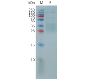SDS-PAGE - Recombinant Human IL-9 Protein (6×His Tag) (A317814) - Antibodies.com