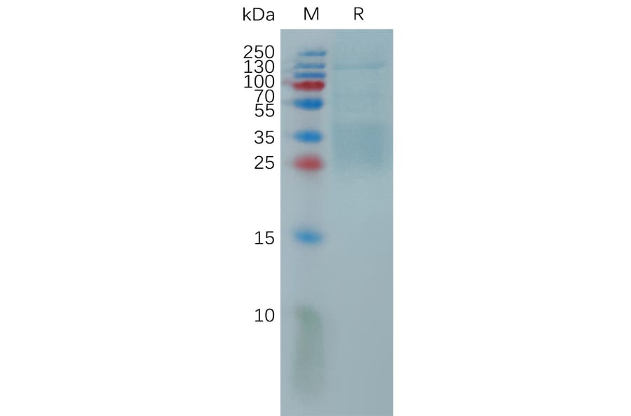 SDS-PAGE - Recombinant Human IL-9 Protein (6×His Tag) (A317814) - Antibodies.com