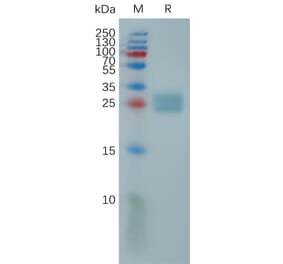 SDS-PAGE - Recombinant Human ULBP2 Protein (6×His Tag) (A317815) - Antibodies.com