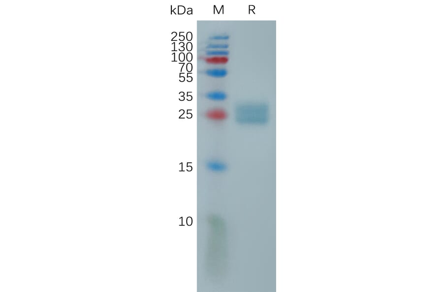 SDS-PAGE - Recombinant Human ULBP2 Protein (6×His Tag) (A317815) - Antibodies.com