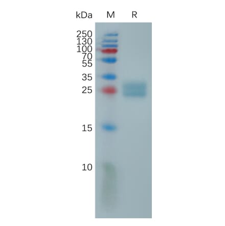 SDS-PAGE - Recombinant Human ULBP2 Protein (6×His Tag) (A317815) - Antibodies.com