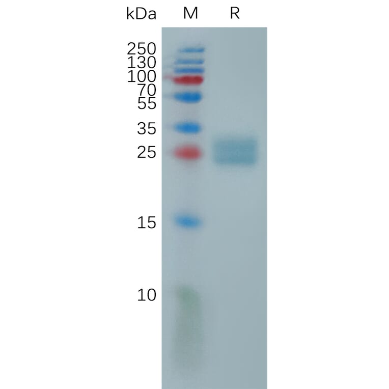 SDS-PAGE - Recombinant Human ULBP2 Protein (6×His Tag) (A317815) - Antibodies.com