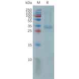 SDS-PAGE - Recombinant Human PR3 Protein (6×His Tag) (A317816) - Antibodies.com