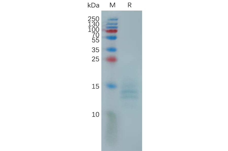 SDS-PAGE - Recombinant Monkeypox Virus A35R Protein (6×His Tag) (A317817) - Antibodies.com