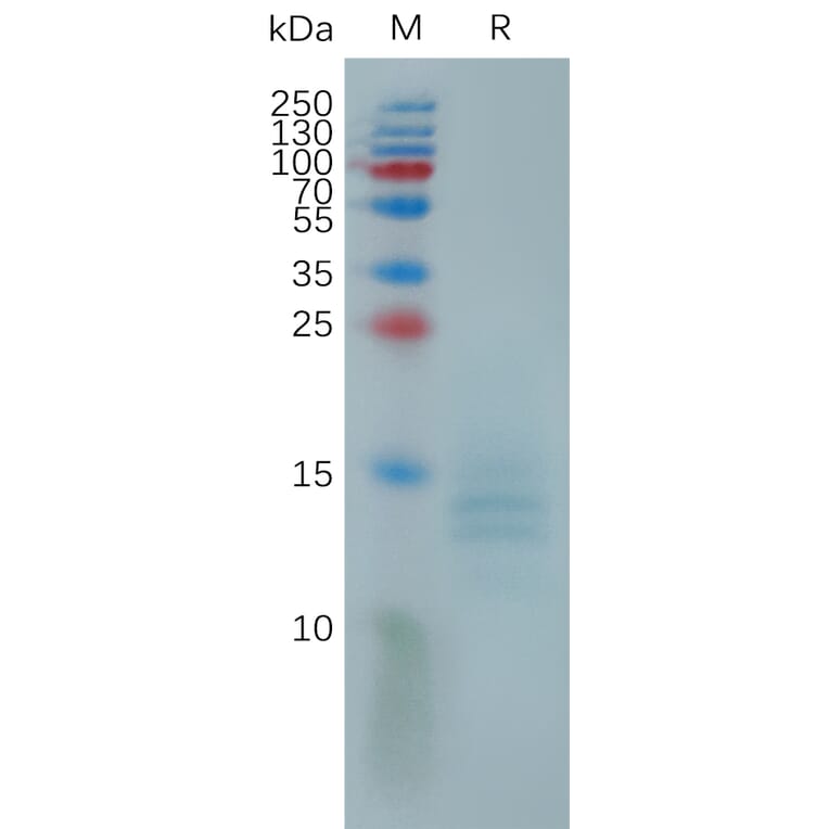 SDS-PAGE - Recombinant Monkeypox Virus A35R Protein (6×His Tag) (A317817) - Antibodies.com