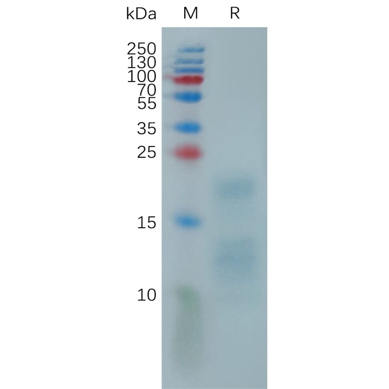 SDS-PAGE - Recombinant Monkeypox Virus A29L Protein (6×His Tag) (A317818) - Antibodies.com