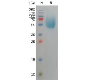 SDS-PAGE - Recombinant Human CD66b Protein (6×His Tag) (A317819) - Antibodies.com