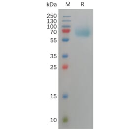 SDS-PAGE - Recombinant Human FGFR3 Protein (6×His Tag) (A317820) - Antibodies.com