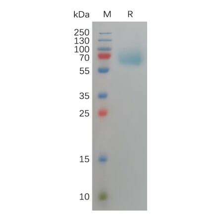 SDS-PAGE - Recombinant Human FGFR3 Protein (6×His Tag) (A317820) - Antibodies.com