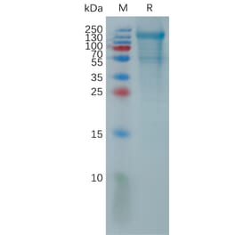 SDS-PAGE - Recombinant Human PCDH18 Protein (6×His Tag) (A317821) - Antibodies.com