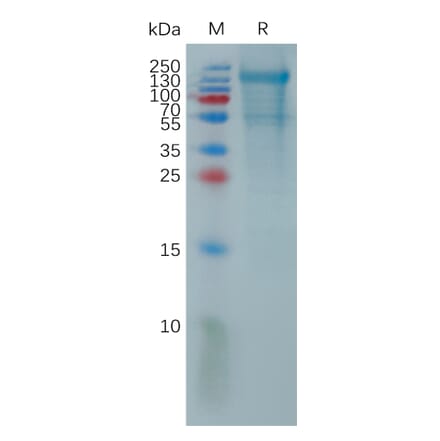 SDS-PAGE - Recombinant Human PCDH18 Protein (6×His Tag) (A317821) - Antibodies.com