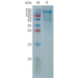 SDS-PAGE - Recombinant Human PCDH18 Protein (6×His Tag) (A317821) - Antibodies.com