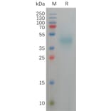 SDS-PAGE - Recombinant Human DLK-1 Protein (6×His Tag) (A317822) - Antibodies.com