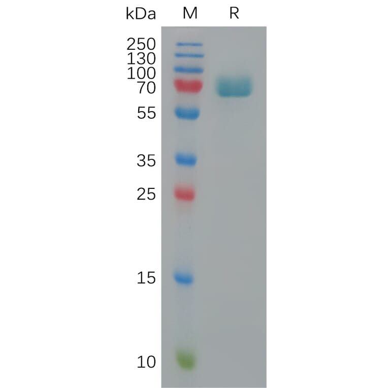 SDS-PAGE - Recombinant Human CD239/BCAM Protein (6×His Tag) (A317824) - Antibodies.com