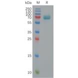 SDS-PAGE - Recombinant Human CD239/BCAM Protein (6×His Tag) (A317824) - Antibodies.com