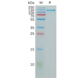 SDS-PAGE - Recombinant Human VCAM1 Protein (Fc Tag) (A317825) - Antibodies.com