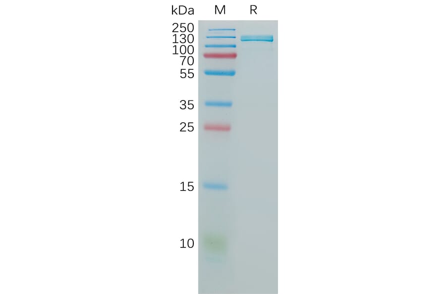 SDS-PAGE - Recombinant Human VCAM1 Protein (Fc Tag) (A317825) - Antibodies.com