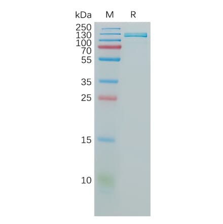 SDS-PAGE - Recombinant Human VCAM1 Protein (Fc Tag) (A317825) - Antibodies.com