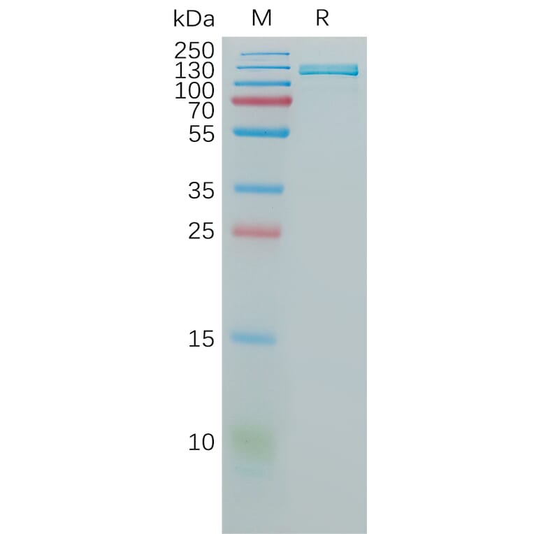 SDS-PAGE - Recombinant Human VCAM1 Protein (Fc Tag) (A317825) - Antibodies.com