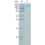 SDS-PAGE - Recombinant Human VCAM1 Protein (Fc Tag) (A317825) - Antibodies.com