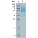 SDS-PAGE - Recombinant Human CD208 Protein (6×His Tag) (A317826) - Antibodies.com