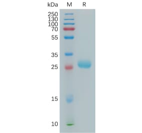SDS-PAGE - Recombinant Human BTN3A2 Protein (6×His Tag) (A317827) - Antibodies.com
