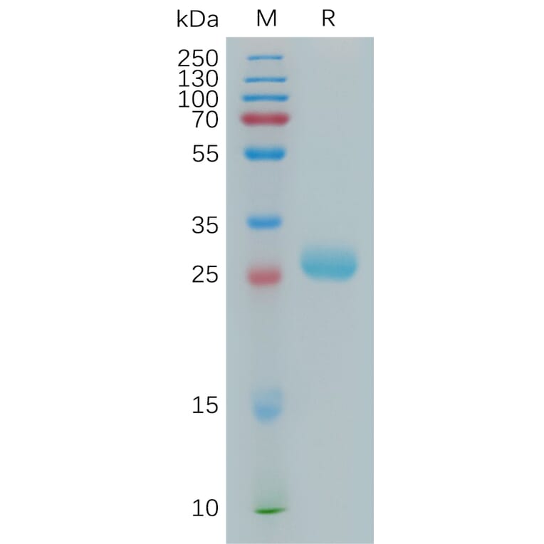 SDS-PAGE - Recombinant Human BTN3A2 Protein (6×His Tag) (A317827) - Antibodies.com