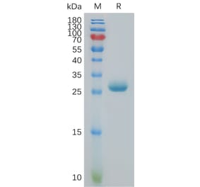 SDS-PAGE - Recombinant Human BTN3A3 Protein (6×His Tag) (A317830) - Antibodies.com